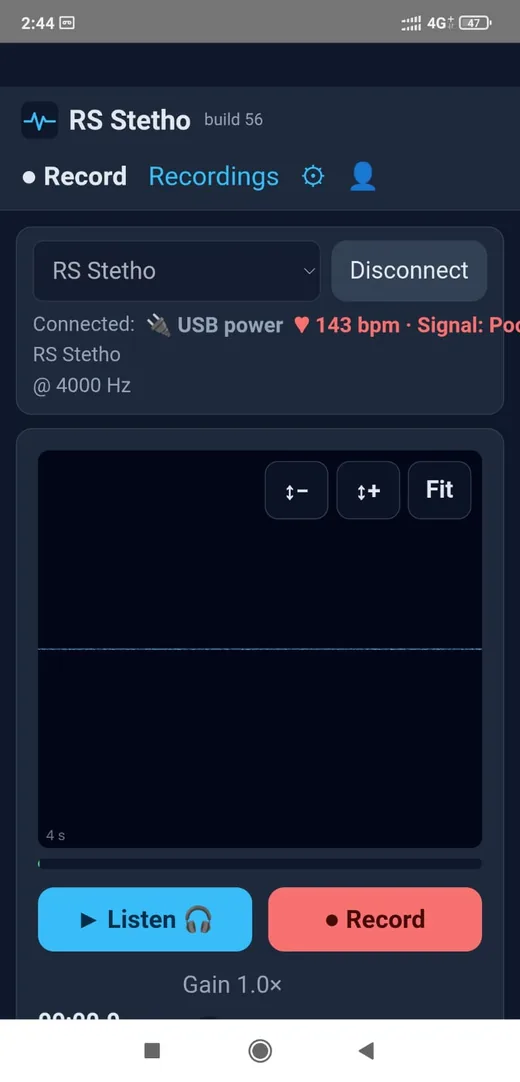 RS Stetho Android app recording screen
