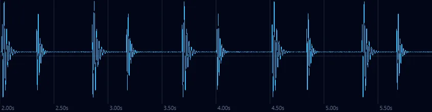 Heart sound waveform zoomed to individual beats